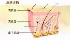 夏末秋初，免疫力低的人最易染上這6大皮膚病